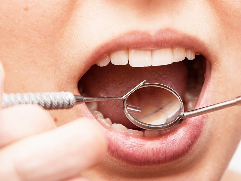 Periodontics Periodontics