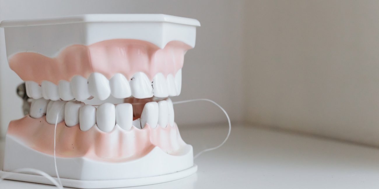 dental_implants_dentist_Seattle