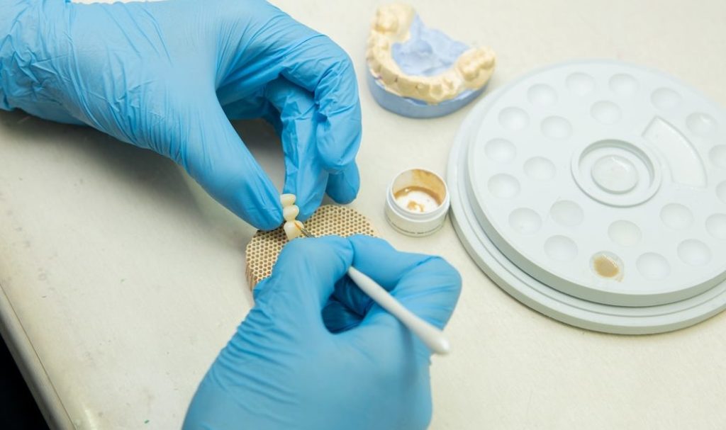 dental_implants_Seattle_dentist