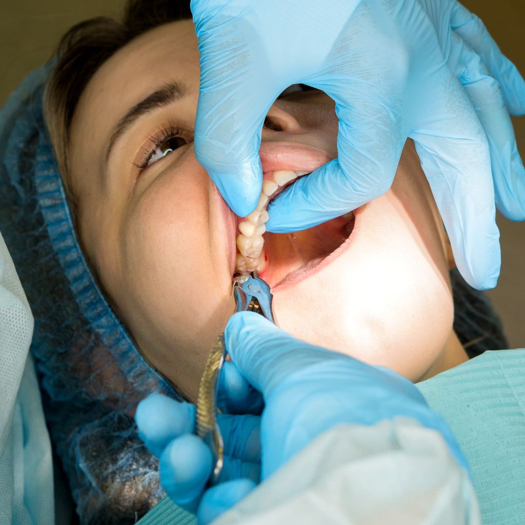 Oral Surgery in Seattle, WA wisdom teeth removal