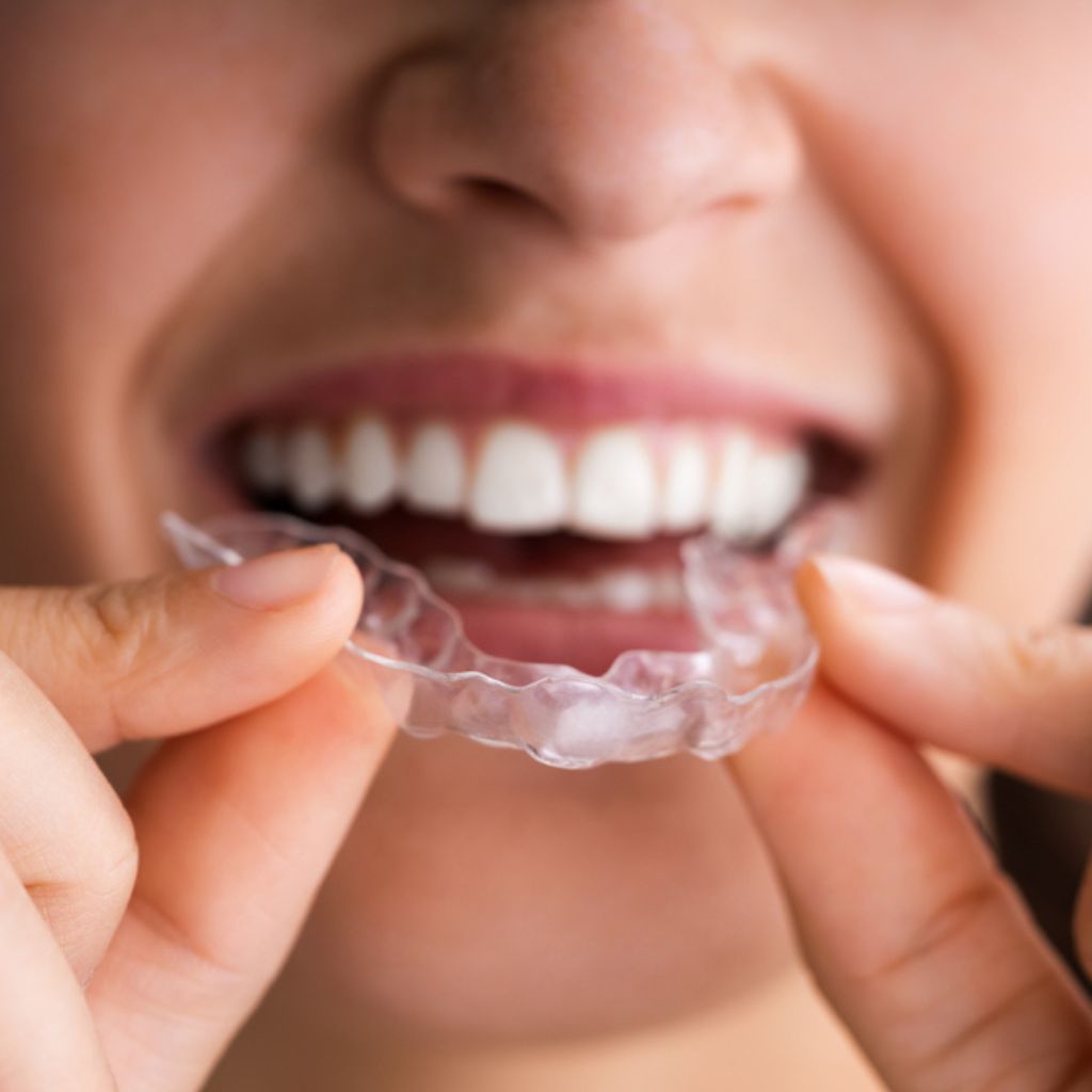 Cosmetic Dentistry in Seattle, WA Cosmetic Dentistry in Seattle, WA | oral surgery seattle