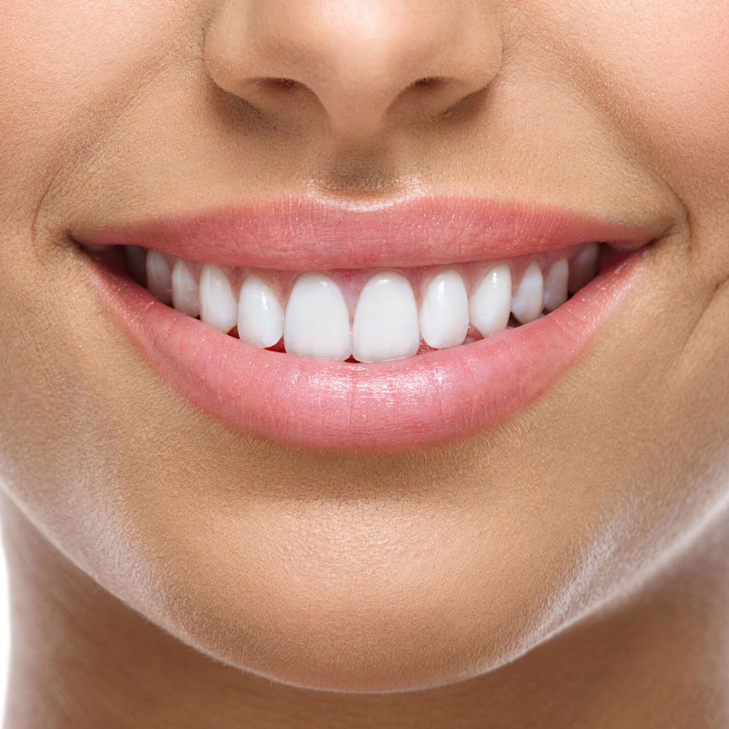 Cosmetic Dentistry in Seattle, WA gum contouring