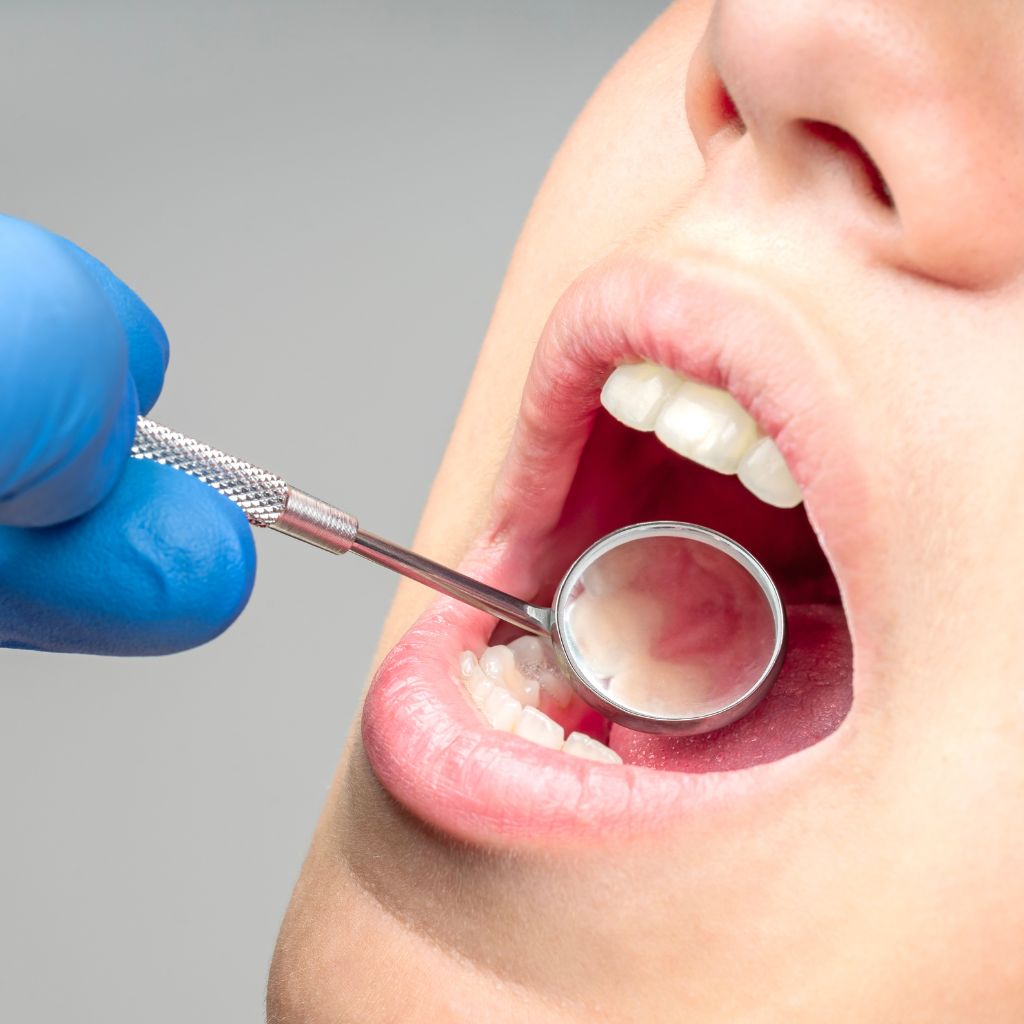 periodontist checkup