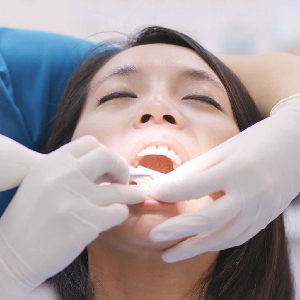 Scaling and Root Planing in Seattle, WA | oral surgery seattle