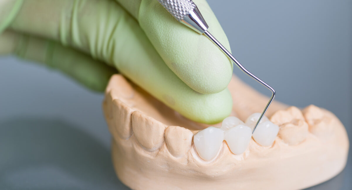 Hand of dentist holding dental gypsum models