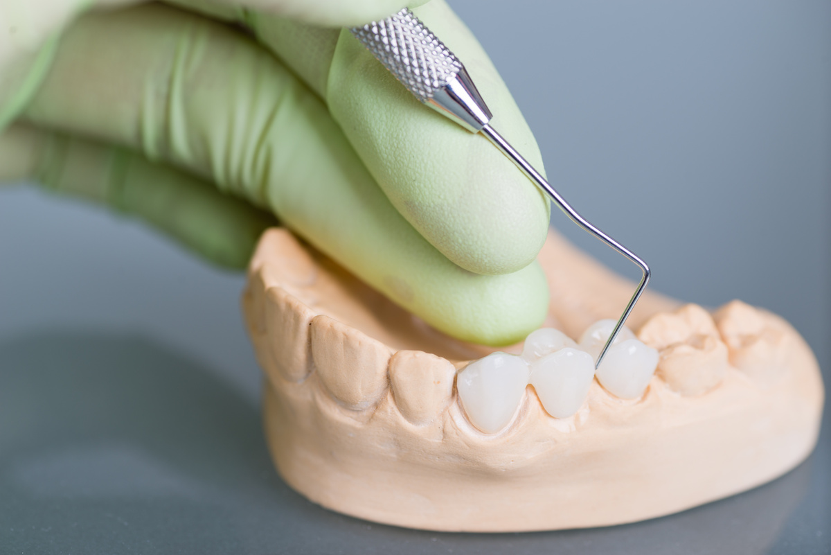 Hand of dentist holding dental gypsum models