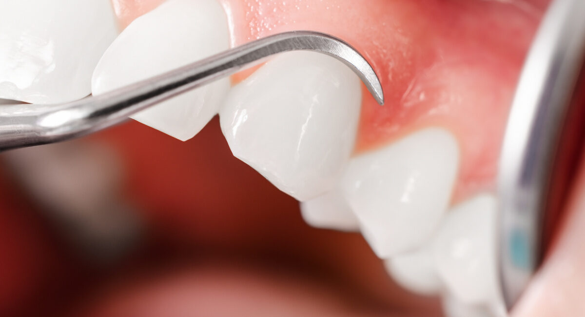 Comprehensive dental examination